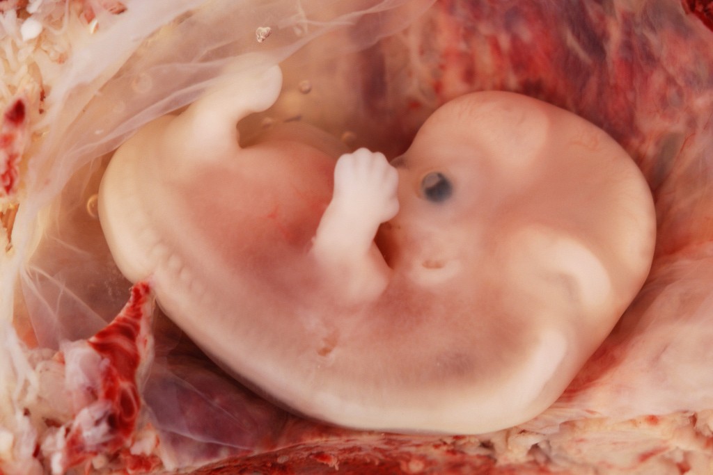 embrión-nueve-semanas-e1370011778983